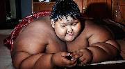 世界最胖男孩380斤 5个小时缩胃手术一个月减掉61斤